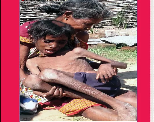 ୧୦ବର୍ଷ ରାଜେଶର ଓଜନ ୧୦ କିଲୋରୁ କମ୍‌