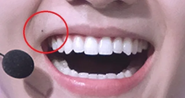 ଶରୀରର ଏହି ଜାଗାରେ କଳାଜାଇ ଅଛି କି ? ଜାଣନ୍ତୁ , ଆପଣ ପ୍ରେମରେ ମାହିର୍‌