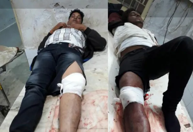 ପୁରୀ: ମହାରାଷ୍ଟ୍ରର ସୁପାରି କିଲର ସହିତ ଅନ୍ୟ ଜଣେ ଦୁର୍ଦ୍ଦାନ୍ତ  ଅପରାଧୀ ପୁଲିସ ଏକକାଉଣ୍ଟରରେ ଆହତ