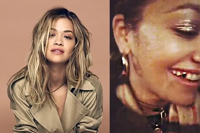 ସୁନା ଦାନ୍ତ ପାଇଁ ଚର୍ଚ୍ଚାରେ ରିଟା!