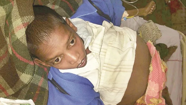 ୧୩ ବର୍ଷର ବାଳକର ପେଟ ଫୁଲୁଛି