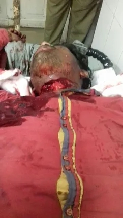 ନିଜ ତଣ୍ଟିକୁ କାଟି ରାସ୍ତାରେ ଗଡ଼ିଲେ ଯୁବକ