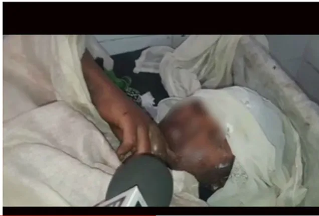 ଦୁଷ୍କର୍ମକୁ ବିରୋଧ କରିବାରୁ ନାବାଳିକାକୁ ଜାଳିଦେଲା