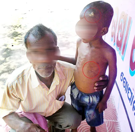 ବର୍ବରତା: ୬ ବର୍ଷର ପାଳିତ ପୁଅକୁ ମାଡ଼, ଚେଂକ!