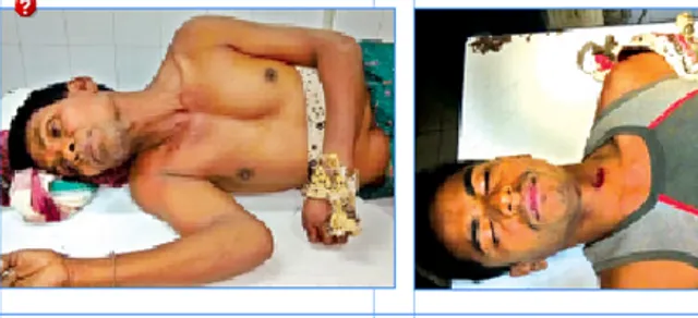 ରାତି ଅଧରେ ଘରୁ ଡାକି ମରଣାନ୍ତକ ଆକ୍ରମଣ: ବାପ-ପୁଅ ଗୁରୁତର