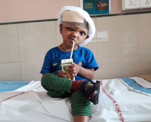 ଜଗାବଳିଆଙ୍କ ଚିକିତ୍ସା ଓଡ଼ିଶାରେ ସମ୍ଭବ