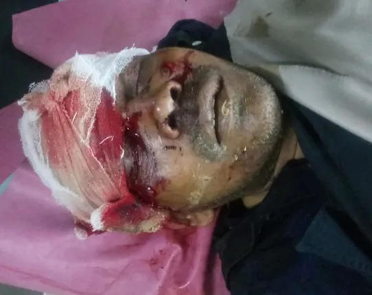 କାର୍‌ ଚାଳକ ଡୋଲେଶ୍ୱର ସାହୁଙ୍କର କଟକ ବଡ଼ ଡାକ୍ତରଖାନାରେ ମୃତ୍ୟୁ