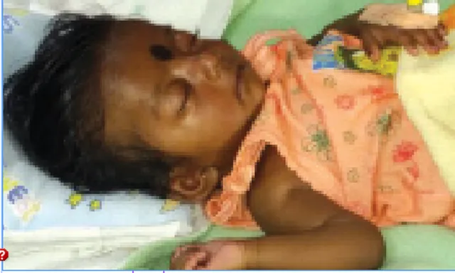 ୪ ମାସର ଶିଶୁକୁ ହୃଦରୋଗ, ସହାୟତା ଲୋଡ଼ିଲା ପରିବାର