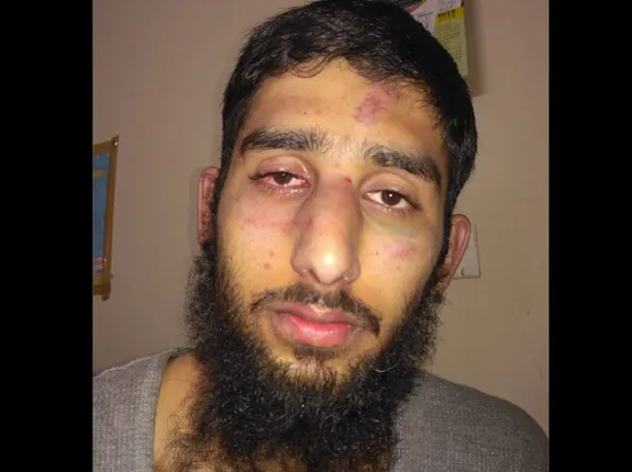 ହରିୟାଣାରେ କଶ୍ମିରୀ ଛାତ୍ରଙ୍କୁ ଆକ୍ରମଣ