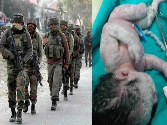 ଆତଙ୍କବାଦୀ ଆକ୍ରମଣ ସମୟରେ ଅନ୍ତସତ୍ତ୍ୱା ମହିଳାଙ୍କୁ ବାଜିଲା ଗୁଳି, ଜନ୍ମଦେଲେ ଏକ ସୁସ୍ଥ ସନ୍ତାନକୁ