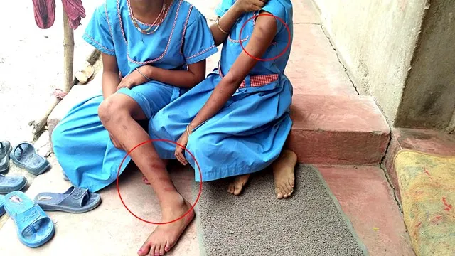 ପ୍ରଧାନଶିକ୍ଷକଙ୍କ ମାଡ଼ରେ ୬ ଛାତ୍ରଛାତ୍ରୀ ଗୁରୁତର