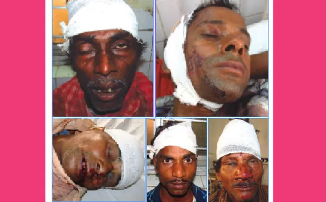 ଗୋରୁ କିଣି ନେଉଥିବା ବେଳେ ଚାଷୀଙ୍କୁ ମରଣାନ୍ତକ ଆକ୍ରମଣ କରି ଲୁଟ୍‌, ୫ ଗୁରୁତର