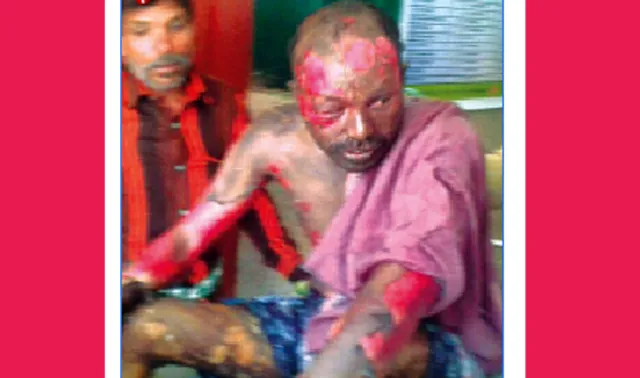 ଦେହରେ ନିଆଁ ଲଗାଇ ଯୁବକଙ୍କ ଆତ୍ମହତ୍ୟା