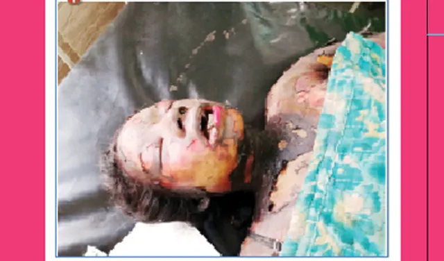 ନିଆଁ ଲଗାଇ ମହିଳାଙ୍କ ଆତ୍ମହତ୍ୟା : କାରଣ ଅସ୍ପଷ୍ଟ!