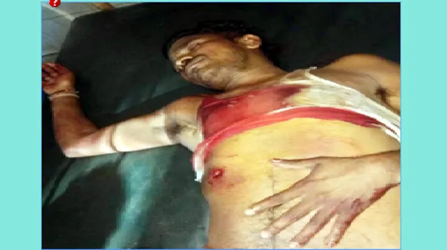 ପୂର୍ବତନ ନାଏବ ସରପଞ୍ଚ ସ୍ୱାମୀଙ୍କୁ ହତ୍ୟା ଉଦ୍ୟମ:ଦଣ୍ଡାବାଡ଼ି ହାଟରେ ଗୁଳି କଲେ ନକ୍ସଲ