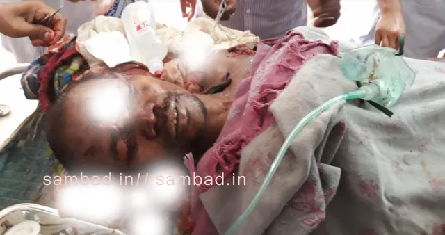 କେନ୍ଦୁଝର: ଭାଲୁ ଆକ୍ରମଣରେ ଜଣେ ମୃତ, ୮ ଗୁରୁତର