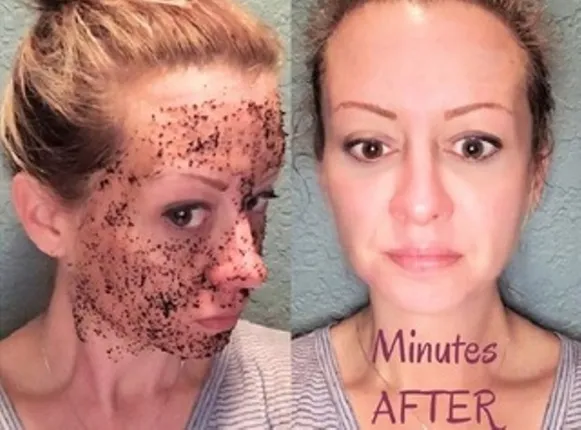 ବୟସ ୫ ବର୍ଷ କମ୍‌ କରିବା ପାଇଁ ଆପଣାନ୍ତୁ ଏହି ଉପାୟ!