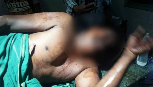 ଶୋଇବାବସ୍ଥାରେ ପ୍ରାଣାନ୍ତକ ଆକ୍ରମଣ ମାମଲା : ସ୍ତ୍ରୀଙ୍କ ଉପରୁ ସନ୍ଦେହ ହଟିଲା 