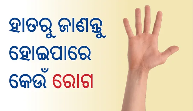 ଆପଣଙ୍କ ହାତ ଏପରିକି , ଜାଣନ୍ତୁ କେଉଁ ରୋଗର ଶିକାର ହୋଇପାରନ୍ତି