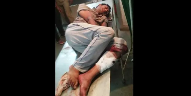 କେନ୍ଦ୍ରାପଡ଼ା: ପୁଲିସ ଗୁଳିରେ ଦୁର୍ଦ୍ଦାନ୍ତ ଅଭିଯୁକ୍ତ ଗୁରୁତର