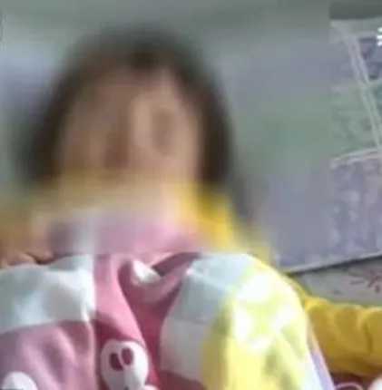 ଏକବର୍ଷର ଶିଶୁ ଗଳାରେ ୮ଦିନ ହେବ ଫସିଥିବା କାନଫୁଲ ବାହାରିଲା