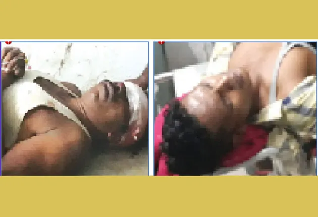 ବାଇକ୍‌ରୁ ପଡ଼ି ୨ ଗୁରୁତର