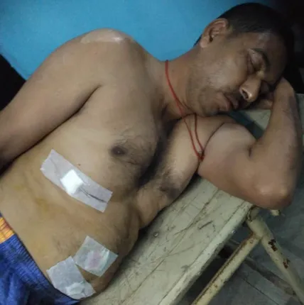 ପାରାଦୀପ: ଛୁରାମାଡ଼ରେ ସିଆଇଏସ୍‌ଏଫ ହାବିଲଦାର ଗୁରୁତର, କଟକ ସ୍ଥାନାନ୍ତର