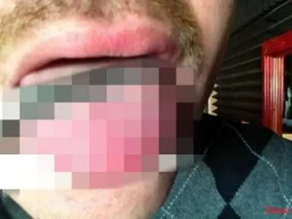 ସଡ଼କ ଦୁର୍ଘଟଣାରେ ଛାତ୍ରଙ୍କ ଜିଭ କଟି ଗଳାରେ ଫସିଲା, ହସ୍‌ପିଟାଲରେ ଚିକିତ୍ସା ଚାଲିଥିବା ସମୟରେ ହେଲା ମୃତ୍ୟୁ