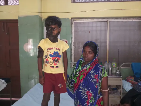 ଲୋମଶ କାହ୍ନାର ଅସ୍ତ୍ରୋପଚାର ଆରମ୍ଭ : ୧୨ ଜଣିଆ ଡାକ୍ତରୀ ଦଳର ୬ ଘଣ୍ଟା କସରତ, ସ୍କିନ୍‌ ଗ୍ରାଫ୍‌ଟିଂ ଶେଷ, ତିନି ମାସ ପରେ ଦ୍ୱିତୀୟ ପର୍ଯ୍ୟାୟ