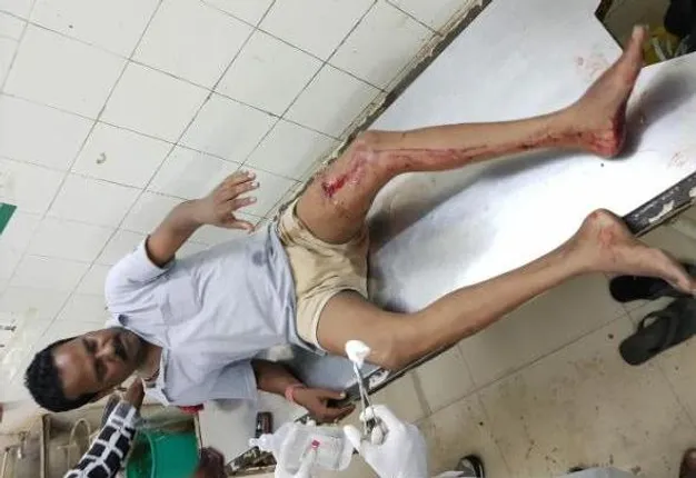 ସମ୍ବଲପୁର: ରେଳବାଇ କଲୋନି ନିକଟରେ ବଚସାରୁ ଗୁଳିକାଣ୍ଡ; ଜଣେ ଆହତ