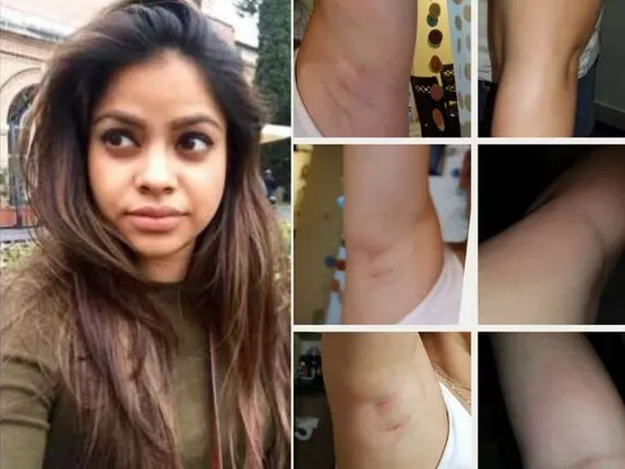 ଓ୍ଵାକ୍ସିଙ୍ଗ କରିବା ପଡ଼ିଲା ମହଙ୍ଗା: ଓ୍ଵାକ୍ସିଙ୍ଗ କରିବା ପରେ ଲାଲ ପଡ଼ିଗଲା ପରଦା ଉପରେ କପିଲ ଶର୍ମାଙ୍କ ସ୍ତ୍ରୀ ହେଉଥିବା ସୁମୋନା ଚକ୍ରବର୍ତ୍ତୀଙ୍କ ଶରୀର