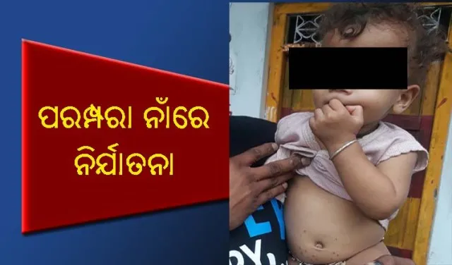 ପରମ୍ପରା ନାଁରେ ନିର୍ଯାତନା : ଚିତାଲାଗି ଅମାବାସ୍ୟା ବୋଲି ୨୩ରୁ ଊର୍ଧ୍ୱ ଶିଶୁଙ୍କୁ ଚେଙ୍କ