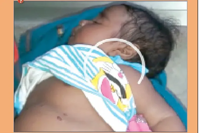 ୨ ମାସର ଶିଶୁକୁ ଚେଙ୍କ