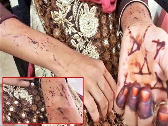 ମାମୁ ପୁଅ ଭାଇ ସମେତ ୬ ଜଣ କଲେ ଦୁଷ୍କର୍ମ; ଚିତ୍କାର କରିବାରୁ ବ୍ଲେଡରେ କାଟିଦେଲେ ହାତ !