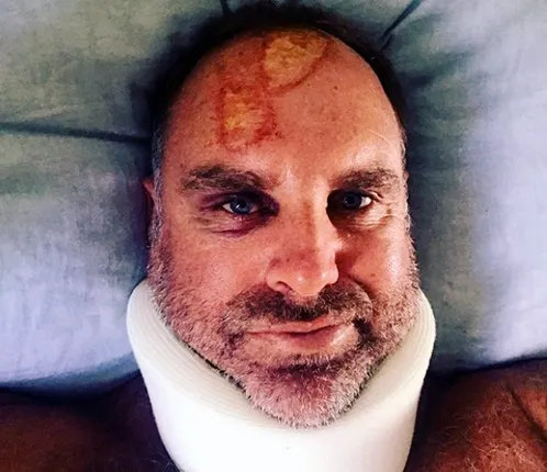 ଦୁର୍ଘଟଣାରେ ହେଡେନ୍‌ ଆହତ