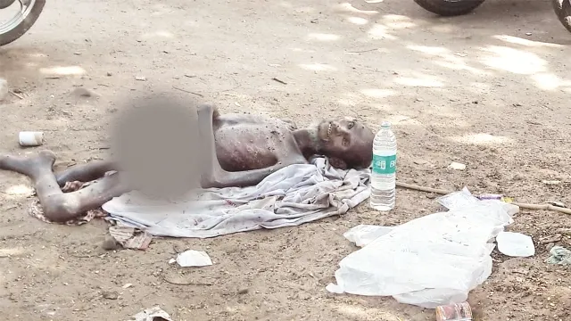 ଏସ୍‌ସିବିରେ ଅଭାବନୀୟ ଦୃଶ୍ୟ : ଚିକିତ୍ସା ମିଳିଲାନି; ଗଛମୂଳେ ଆଖିବୁଜିଲେ ଅସହାୟ ରୋଗୀ