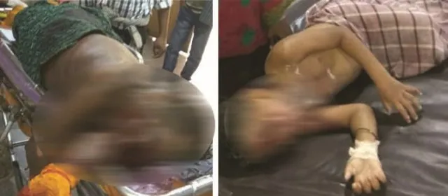 ବାଣ ଭିଡ଼ିବା ବେଳେ ବିସ୍ଫୋରଣ : ଅଜା ମୃତ, ନାତି ଗୁରୁତର