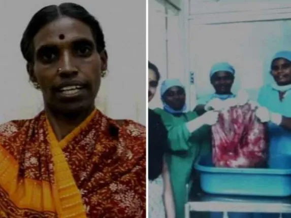 ମହିଳାଙ୍କ ପେଟରୁ ବାହାରିଲା ୩୩.୫ କିଲୋର ଟ୍ୟୁମର! ଏତେ ବଡ଼ ଟ୍ୟୁମର ବିଶ୍ୱରେ ପ୍ରଥମ ହୋଇଥିବା ନେଇ ଚର୍ଚ୍ଚା