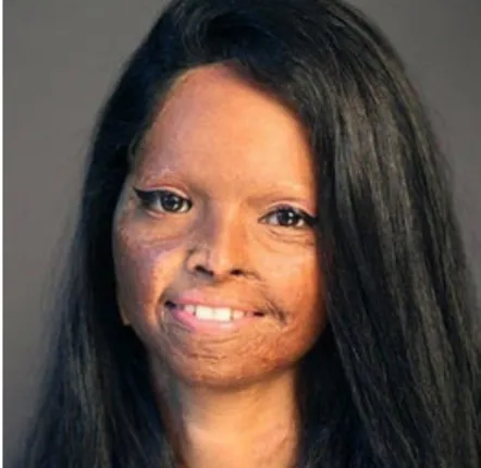 ଏସିଡ୍‌ ପୀଡ଼ିତା ଲକ୍ଷ୍ମୀ ଅଗ୍ରଓ୍ଵାଲ୍‌ ହେବେ ଏହି ନାମୀ ନାୟିକା!