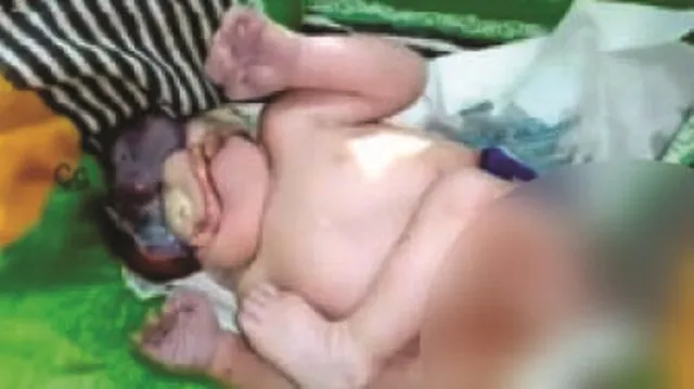 ଅଦ୍ଭୁତ ଶିଶୁ କନ୍ୟା ଜନ୍ମ