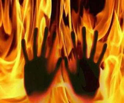 କଲେଜ ଛାତ୍ରୀ ଜଳିଗଲେ