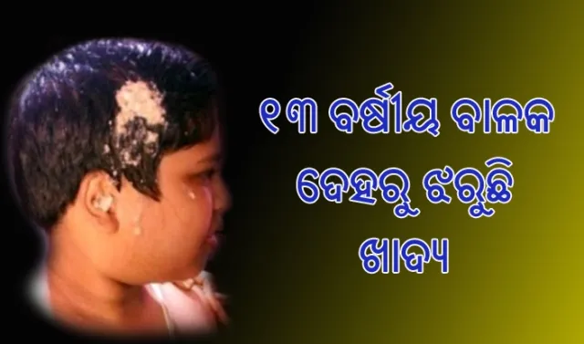 ବିଚିତ୍ର ରୋଗ : ୧୩ ବର୍ଷୀୟ ବାଳକ ଦେହରୁ ବାହାରୁଛି ଖାଇବା ଖାଦ୍ୟ!