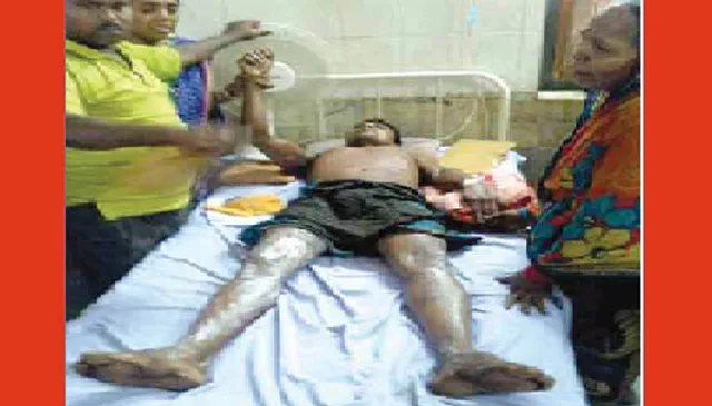 ଚା’ ଦୋକାନୀଙ୍କୁ ତତଲା ତେଲ ଫିଙ୍ଗିବା ଘଟଣା:ରୋଗୀ ବାରଦୁଆର, ମିଳୁନି ସ୍ବାସ୍ଥ୍ୟ ବୀମା ସହାୟତା