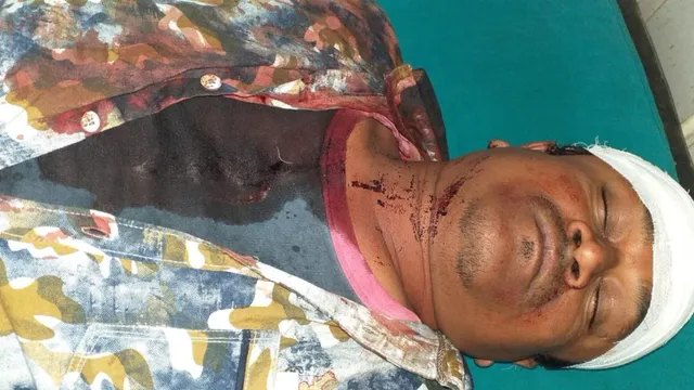 ବାଲେଶ୍ୱର: ଚୋରା ମଦ ବେପାରୀଙ୍କ ଭୁଜାଲି ଚୋଟରେ ସାମ୍ବାଦିକ ଆହତ