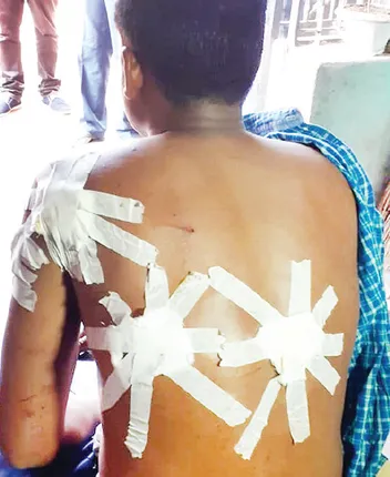 ରାଜଧାନୀରେ ରାତି ଅଧରେ ଗୁଳିମାଡ଼ ଘଟଣା: ଡ୍ୟାନ୍ସବାରକୁ ନେଇ ଗଣ୍ଡଗୋଳ ସନ୍ଦେହ