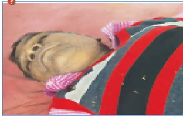 ତଳେ ପଡ଼ି ଯାଇ ଖଣି କର୍ମଚାରୀଙ୍କ ମୃତ୍ୟୁ