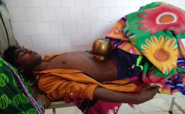 ବୈଜ୍ଞାନିକ ଯୁଗରେ ଅନ୍ଧବିଶ୍ୱାସ: ପେଟ ଯନ୍ତ୍ରଣା ହେବାରୁ ପ୍ରାକୃତିକ ଉପାୟରେ ଚିକିତ୍ସା ଉଦ୍ୟମ, ବିଫଳ ପରେ ‘ଏମ୍‌କେସିଜି’ରେ ଭର୍ତ୍ତି