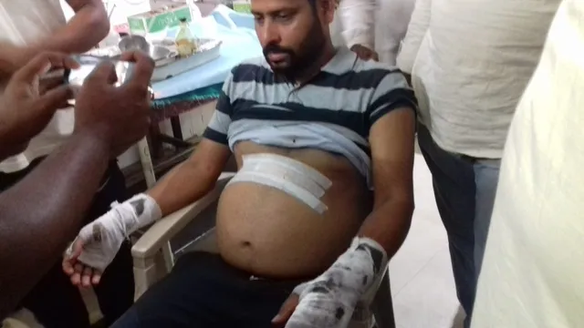 କେନ୍ଦୁଝର: ଗୁଳିମାଡ଼ କରି ଲୁଟିଲେ ଦୁର୍ବୃତ୍ତ, ଯୁବକଙ୍କୁ ହସ୍‌ପିଟାଲରେ ଭର୍ତ୍ତି