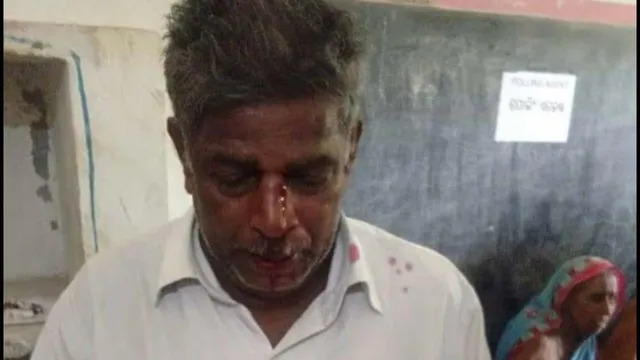 ନିଆଳିରେ ଦୁଇ ପ୍ରତିଦ୍ବନ୍ଦ୍ବୀ ଦଳର କର୍ମୀଙ୍କ ଗଣ୍ଡଗୋଳ ଯୋଗୁଁ ବିଜେପି ଏଜେଣ୍ଟ ଆହତ, ଡାକ୍ତରଖାନାରେ ଭର୍ତ୍ତି