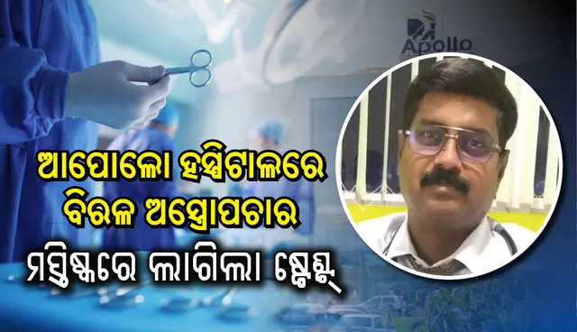 ଆପୋଲୋ ହସ୍ପିଟାଲରେ ବିରଳ ଅସ୍ତ୍ରୋପଚାର, ମସ୍ତିଷ୍କରେ ଲାଗିଲା ଷ୍ଟେଣ୍ଟ୍